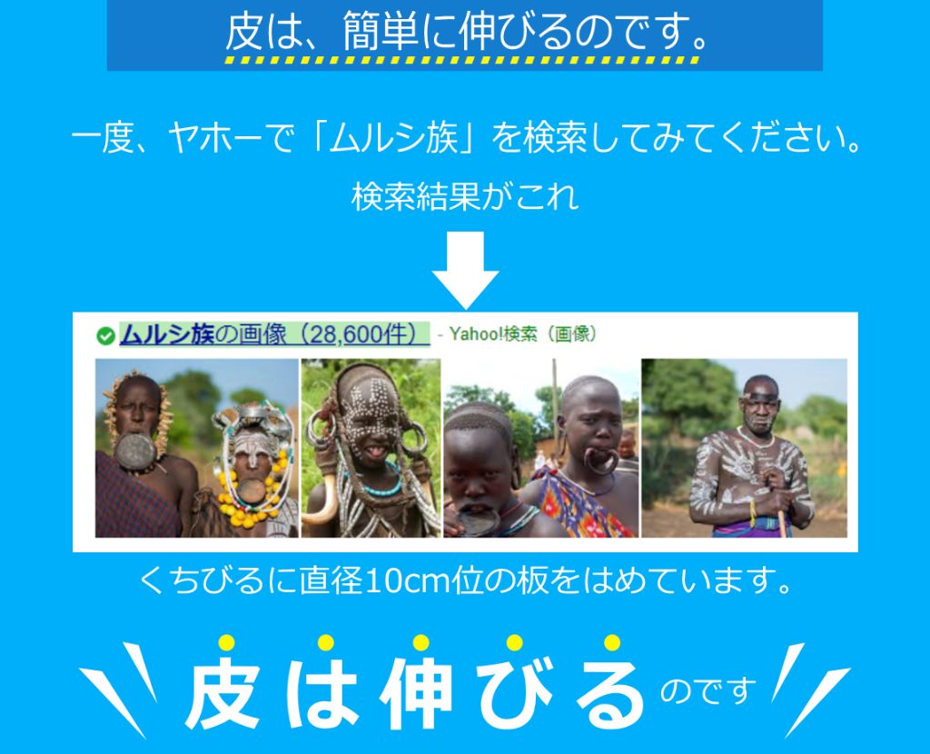 キトーくんの基本構造と目的