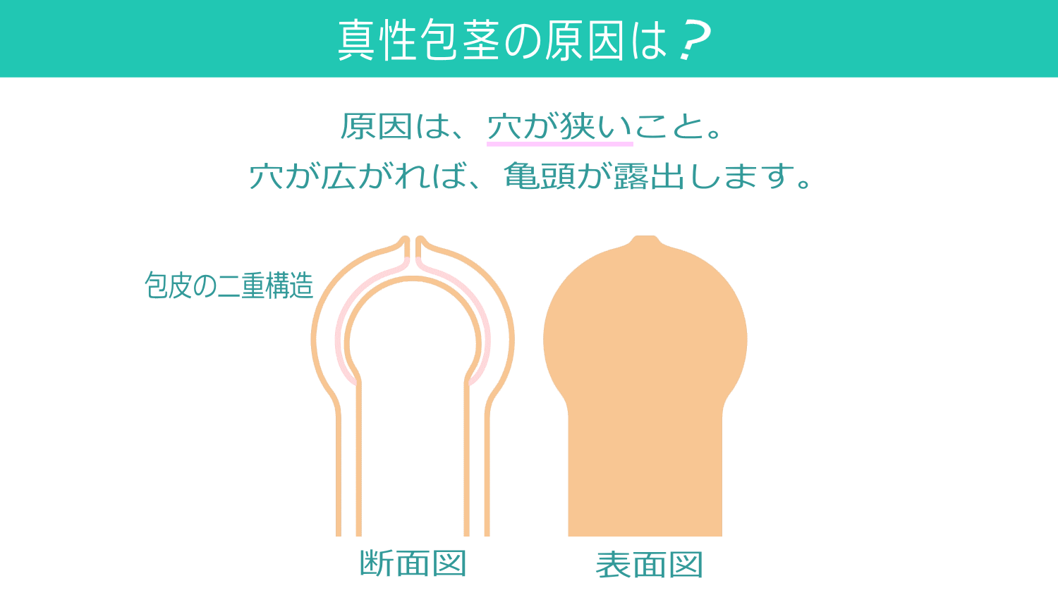 キトーくんの基本構造と目的